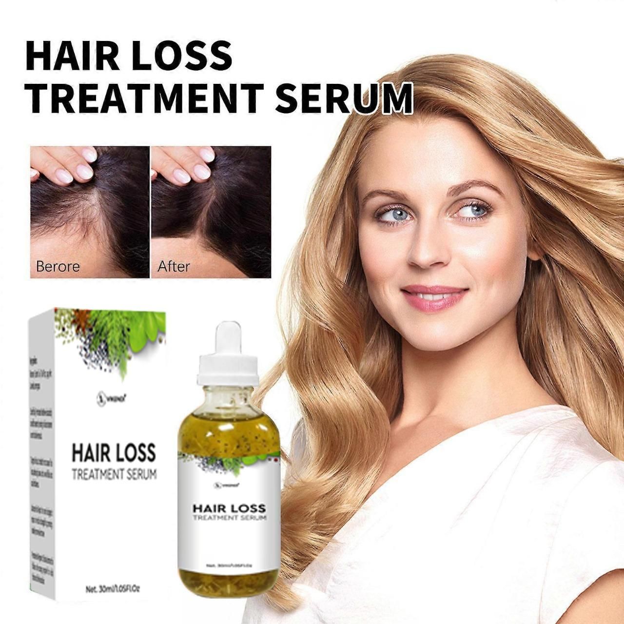 Hair Loss Treatment Serum 30ML (Pack of 2)